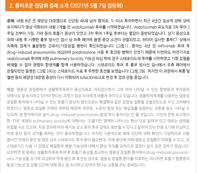 안내메일