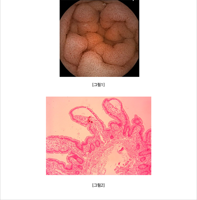 안내메일
